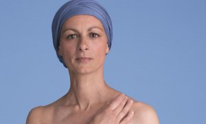 Lékaři upozorňují na vhodnou péči o pokožku pro onkologicky nemocné