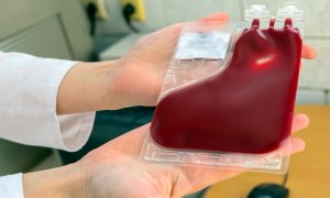 10 důvodů pro odběr pupečníkové krve