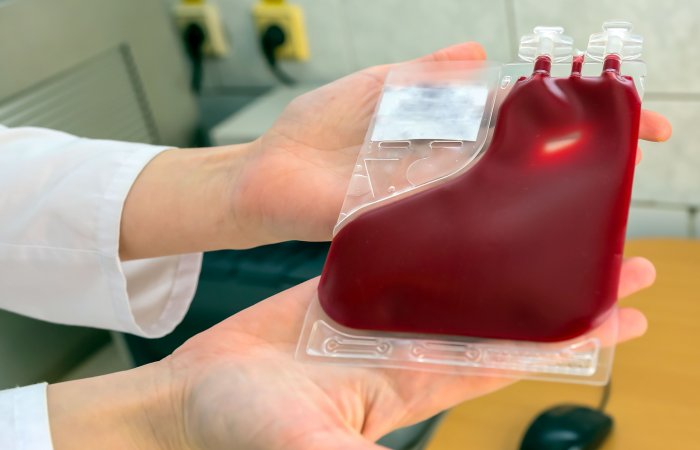 10 důvodů pro odběr pupečníkové krve