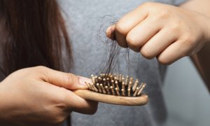 Jaký dopad má hubnutí na vlasy?